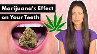 What Does Marijuana Do To Your Teeth?