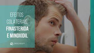 Aplicações e efeitos colaterais de Finasterida e Minoxidil