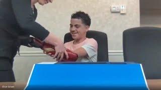 The Alita Army Gifts A Young Boy A Bionic Arm from Open Bionics!