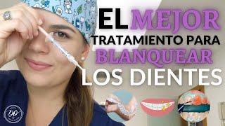 Cuál es el MEJOR BLANQUEADOR DENTAL en 2023 ️