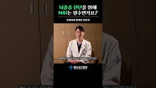 뇌졸중 진단을 위해 MRI는 필수인가요?