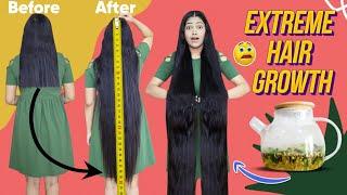 Most Powerful Diy For Triple Hairgrowth गंजे सर पर बाल उगाने का सबसे आसान उपाय Rs0 खर्चा Live Result