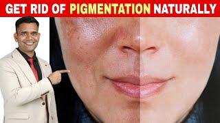 6 Simple Things To Get Rid Of Pigmentation, melasma Naturally