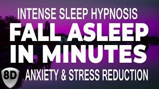  Sleep Hypnosis - Relieve Stress & Anxiety  Calm an Overactive Mind | Guided Meditation Relaxation