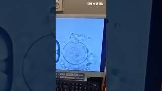 난임의학연구소 미세수정 '리오라여성의원' #난임 #시험관아기 #난임병원