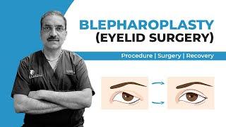 All you need to know about Eyelid Surgery in Delhi (Blepharoplasty Surgery) in India | Dr Soni