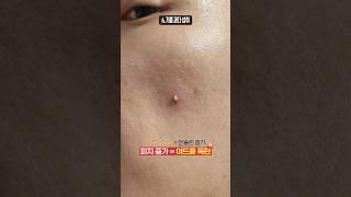 ️피부 ㅈ되는 최악의 습관 10가지️