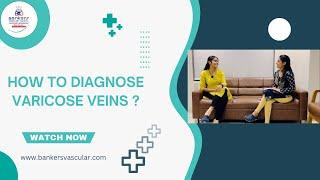how to diagnose varicose veins ?