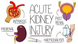 Understanding Acute Kidney Injury (AKI Made Easy)