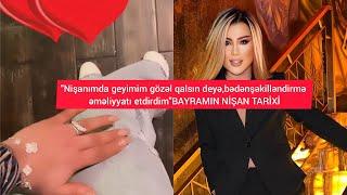 "Nişanımda geyimim gözəl qalsın deyə,bədənşəkilləndirmə əməliyyatı etdirdim"BAYRAMIN NİŞAN TARİXİ