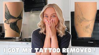 MY LASER TATTOO REMOVAL JOURNEY | PAIN? AFTERCARE? ANSWERING MY MOST FAQ'S !!! 