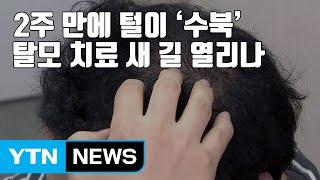 [자막뉴스] 2주 만에 털이 '수북'...탈모 치료 새 길 열리나 / YTN