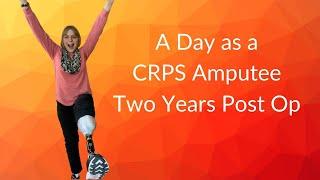 A Day in The Life of a CRPS Amputee Two Years Post Op.