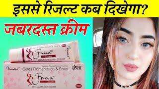 Freia Cream Review: Benefits, Side Effects & How to Use | फ्रेया क्रीम के फायदे, नुक़सान, प्रयोगविधि