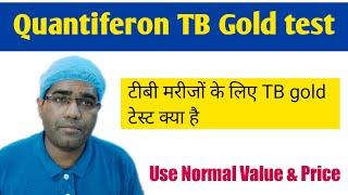 Quantiferon TB Gold test in Hindi | टीबी मरीजों के लिए TB gold टेस्ट क्या है | Result & Normal value