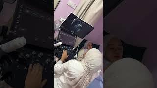 SCAN KANDUNGAN KAT POLIKLINIK ANNA JASIN MELAKA.