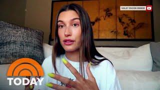 Hailey Bieber Opens Up About ‘Mini-Stroke’ Health Scare