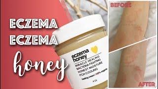 Review of Eczema Honey Co Product // Michelle Mills