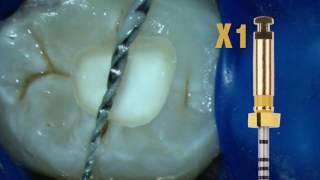 ProTaper Next™ Technique with Dr. Scianamblo | Dentsply Sirona