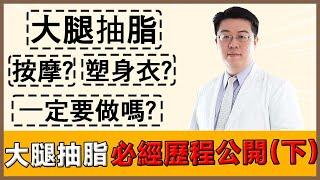 大腿抽脂必經歷程完整公開(下) 抽脂塑身衣穿脫攻略?! 抽脂術後多久可以運動? 抽脂術後按摩怎麼按? ｜林敬鈞醫師｜巨星整形外科