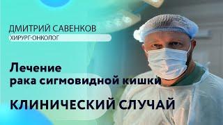 Дмитрий Савенков I Хирург-онколог I Зав. отделением I Клинический случай