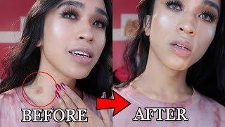How I Hide My First Hickey ( it’s painful af  )