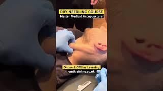 #dryneedling Training | OMT Training  #acupuncture #chiropractor