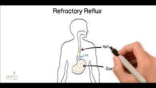 PPI-Resistant Reflux