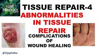 TISSUR REPAIR Part 4: Abnormalities in tissue repair