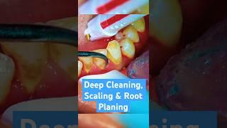 How to Perform a Deep Cleaning