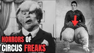 10 Circus freaks That Actually Existed | Rarest Photos