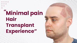 Minimal pain Hair Transplant Experience @EugenixHairSciencesofficial