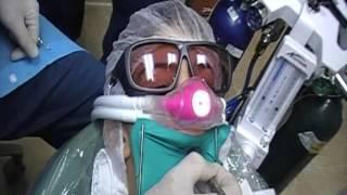 Safe Amalgam Removal on a Child