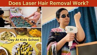Does Laser Hair Removal Work At Home | A Day At Kids School | Fried Chicken Popcorns | Mom Routine