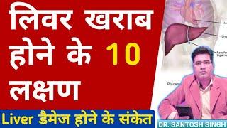 Liver Kharab Hone Ke Lakshan, | Liver Damage Symptoms and Sign Explained..