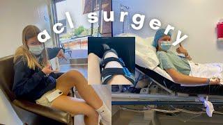 my acl surgery (1 week recovery/experience)