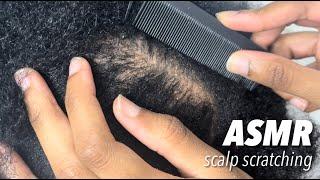 ASMR Scalp Scratching to help you relax‍️