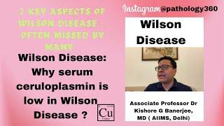 Why Serum Ceruloplasmin is low in Wilson Disease? 2 key features of #WilsonDisease #medicine #md