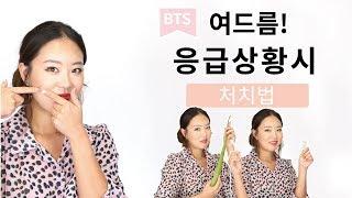 [BTS] 여드름 응급상황 처치방법! [Dr.KRISMAS:BTS]