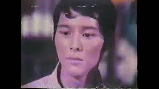 Ronnie Henares Colgate Commercial 1970