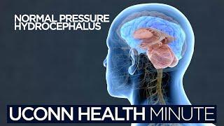 UConn Health Minute: Normal Pressure Hydrocephalus