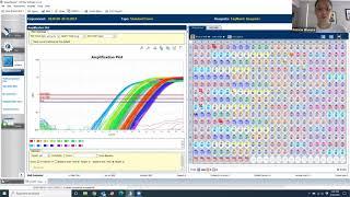 PCR analysis - telomere results