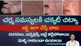 How to Get Relief from Itching | Parasitic Infection | Albendazole Tablets | Dr.Ravikanth Kongara