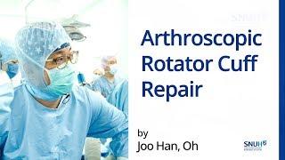 Arthroscopic Rotator Cuff Repair Surgery