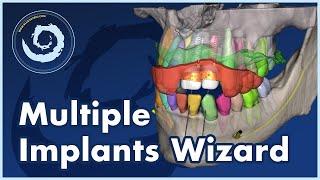 V4.13: Plan a Multiple Implant Case in Minutes.- Watch How!