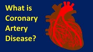 What is Coronary Artery Disease?