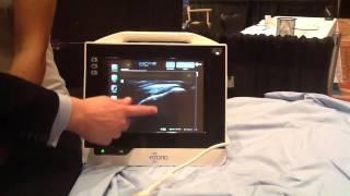 Introducing MSK Ultrasound dream system