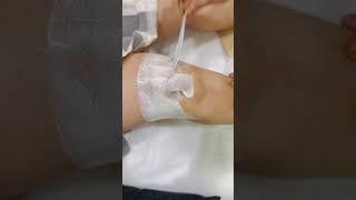 Knee waxing #wax #hairgrowth #hairremoval #trendingshorts #youtube #shortsfeed #asmr #tutorial #fyp