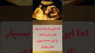 ایا امکان بارداری مجدد در دوران بارداری وجود دارد ؟؟؟ #shorts #viral