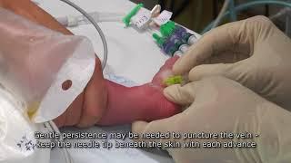 Paediatric Anaesthetics: Chapter 7 - Long saphenous IV neonate 1